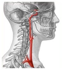 Problemi nelle arterie legati alla bocca